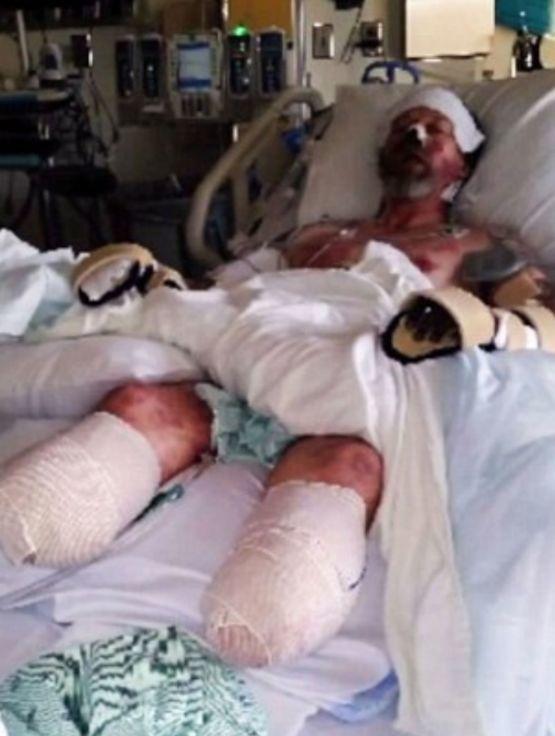 舔一舔就讓你斷手斷腳!男子被狗舔不到20天就死亡 可怕的是這非個案...:要很小心啊