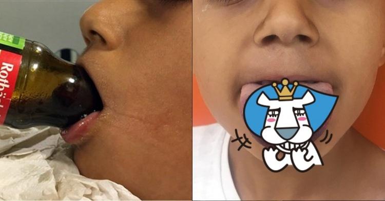 為了一滴果汁都不留！德國男童「舌舔玻璃瓶塞住變這樣」悽慘畫面遭公開...網：恐怖！