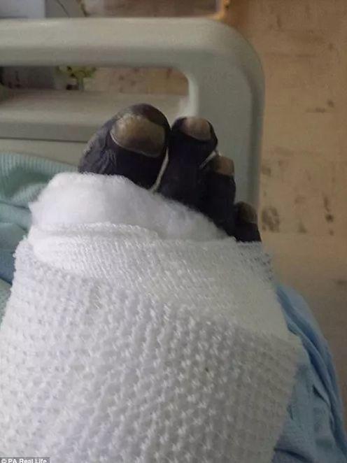 舔一舔就讓你斷手斷腳!男子被狗舔不到20天就死亡 可怕的是這非個案...:要很小心啊