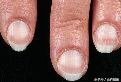 腎不好的8個信號，你佔了幾個？教你三招，養好「腎臟」！
