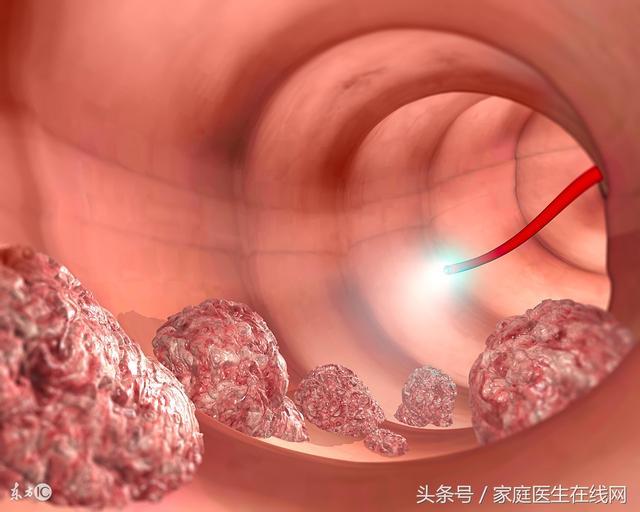 什麼會影響癌細胞的生長速度？醫生大聲地說出了這4件事