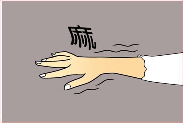 醫生提醒：睡覺時有這種表現就是「中風前兆」！