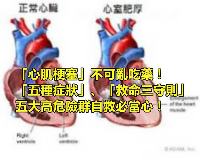 「心肌梗塞」不可亂吃藥!「五種癥狀」、「救命三守則」五大高危險群自救必當心!