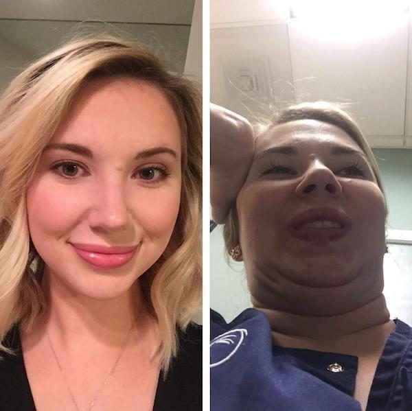 (多图)看正妹「挤出4层双下巴上吊白眼」!